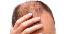 Electric tech could help reverse baldness